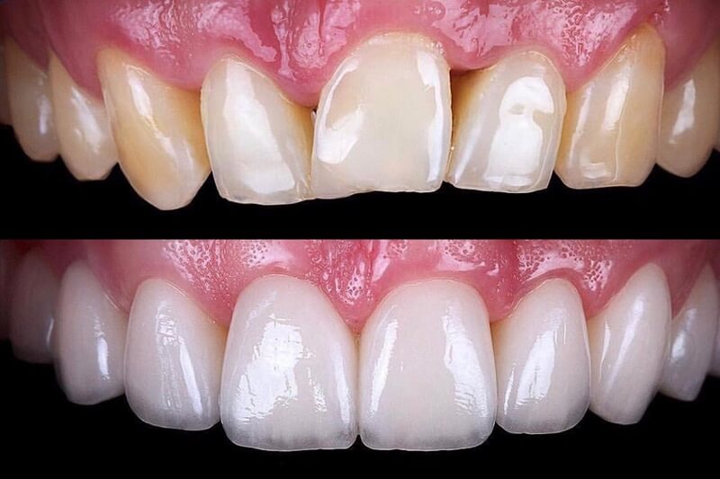Cosmetic Dentistry